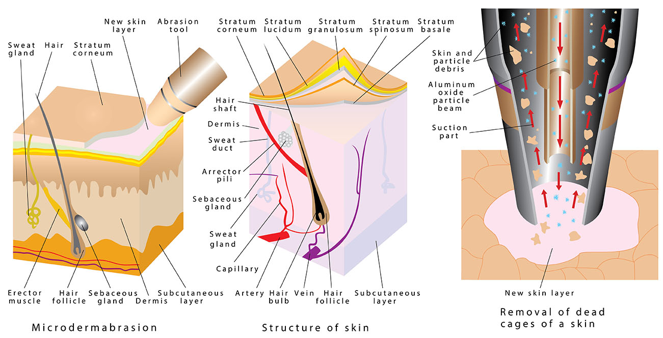 Best Professional Microdermabrasion Machines, Tips & Tricks (2)